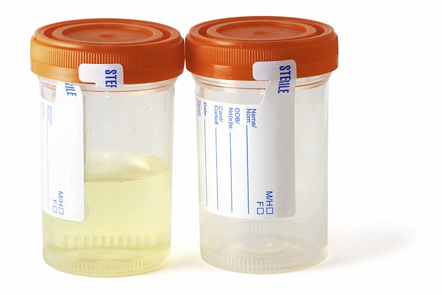 Urine drug testing containers
